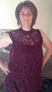 Tracey After Bariatric surgery