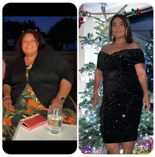 Nikki - Gastric bypass before and after